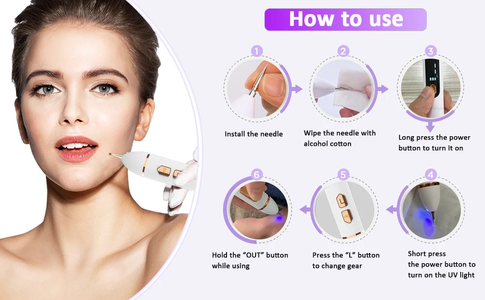 Laser Plasma Pen – Remove Dark Spots, Moles & Skin Tags Instantly!