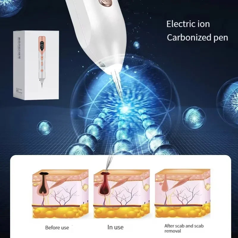 Plasma Laser Pen – Remove Spots & Rejuvenate Instantly!