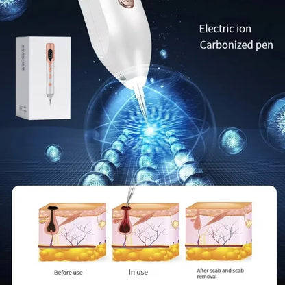 Plasma Laser Pen – Remove Spots & Rejuvenate Instantly!