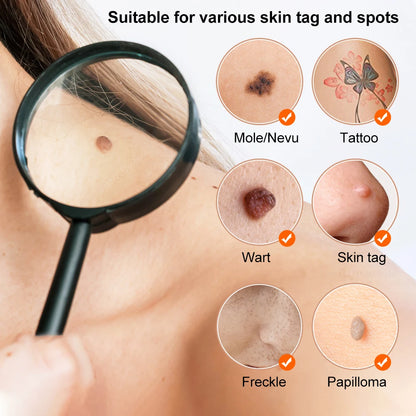 Laser Plasma Pen – Remove Dark Spots, Moles & Skin Tags Instantly!
