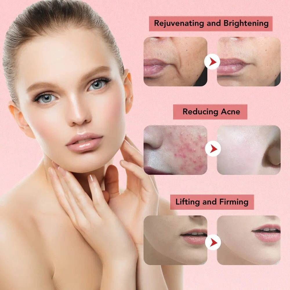 Lifting Facial 7 em 1 com Microcorrente e Luz LED