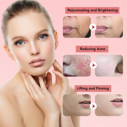 Lifting Facial 7 em 1 com Microcorrente e Luz LED