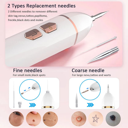 Laser Plasma Pen – Remove Dark Spots, Moles & Skin Tags Instantly!